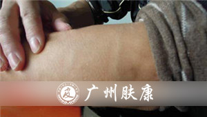 ���ݷ���Ƥ����ҽԺ