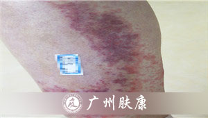 ���ݷ���Ƥ����ҽԺ