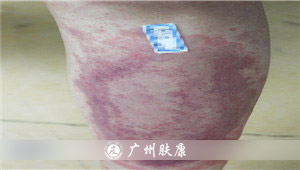 ���ݷ���Ƥ����ҽԺ