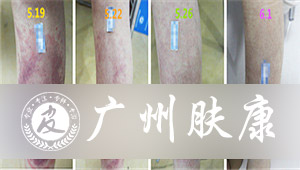 ���ݷ���Ƥ����ҽԺ