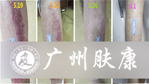 ���ݷ���Ƥ����ҽԺ