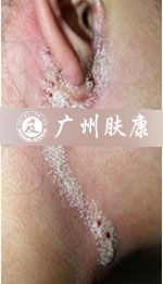 ���ݷ���Ƥ����ҽԺ