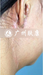 ���ݷ���Ƥ����ҽԺ