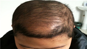 ���ݷ���Ƥ����ҽԺ