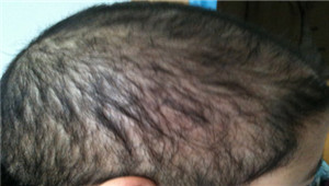 ���ݷ���Ƥ����ҽԺ