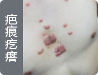 ���ݷ���Ƥ����ҽԺ