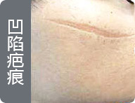 ���ݷ���Ƥ����ҽԺ