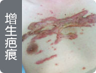 ���ݷ���Ƥ����ҽԺ