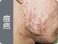 ���ݷ���Ƥ����ҽԺ