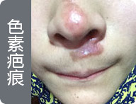 ���ݷ���Ƥ����ҽԺ