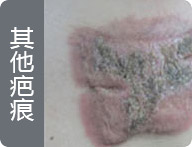 ���ݷ���Ƥ����ҽԺ