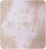 ���ݷ���Ƥ����ҽԺ