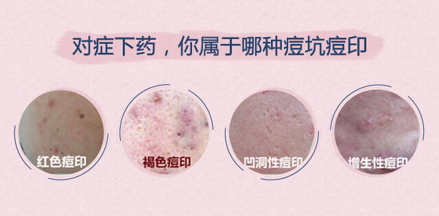 ���ݷ���Ƥ����ҽԺ