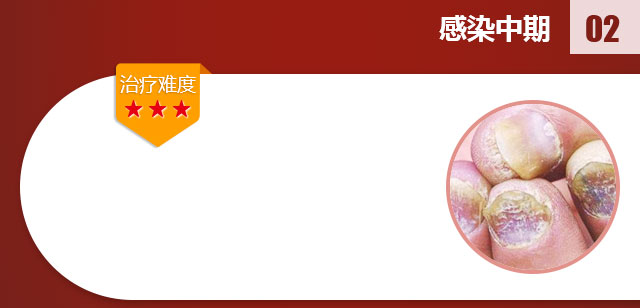 ���ݷ���Ƥ����ҽԺ