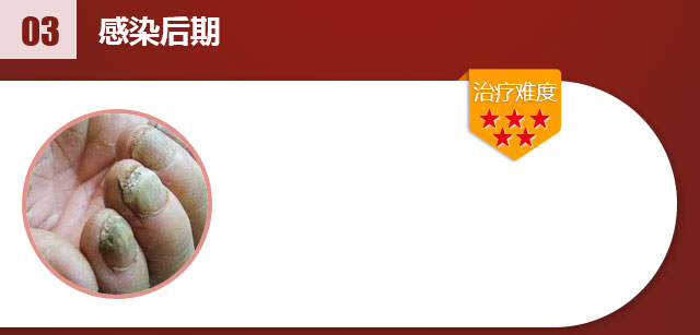 ���ݷ���Ƥ����ҽԺ