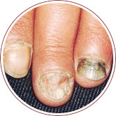 ���ݷ���Ƥ����ҽԺ