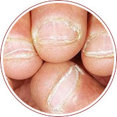 ���ݷ���Ƥ����ҽԺ