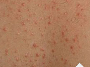 ���ݷ���Ƥ����ҽԺ