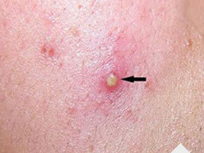 ���ݷ���Ƥ����ҽԺ