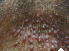 ���ݷ���Ƥ����ҽԺ