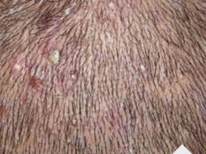 ���ݷ���Ƥ����ҽԺ