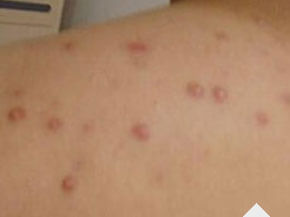 ���ݷ���Ƥ����ҽԺ