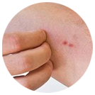 ���ݷ���Ƥ����ҽԺ