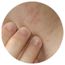 ���ݷ���Ƥ����ҽԺ