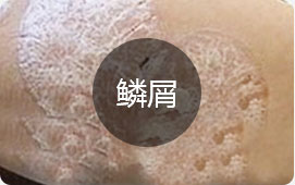 ���ݷ���Ƥ����ҽԺ