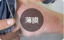 ���ݷ���Ƥ����ҽԺ