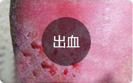 ���ݷ���Ƥ����ҽԺ