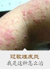 ���ݷ���Ƥ����ҽԺ