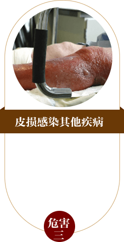 ���ݷ���Ƥ����ҽԺ