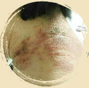 ���ݷ���Ƥ����ҽԺ