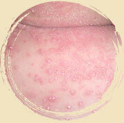 ���ݷ���Ƥ����ҽԺ