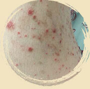 ���ݷ���Ƥ����ҽԺ