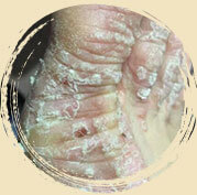 ���ݷ���Ƥ����ҽԺ