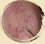 ���ݷ���Ƥ����ҽԺ