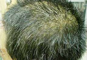 ���ݷ���Ƥ����ҽԺ