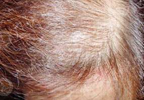 ���ݷ���Ƥ����ҽԺ