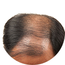 ���ݷ���Ƥ����ҽԺ