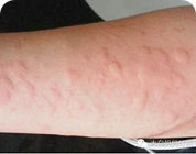 ���ݷ���Ƥ����ҽԺ