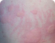 ���ݷ���Ƥ����ҽԺ