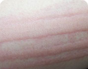 ���ݷ���Ƥ����ҽԺ