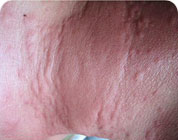 ���ݷ���Ƥ����ҽԺ