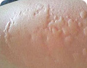 ���ݷ���Ƥ����ҽԺ