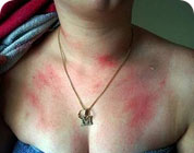 ���ݷ���Ƥ����ҽԺ