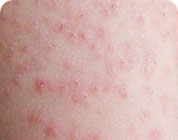 ���ݷ���Ƥ����ҽԺ