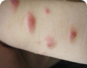 ���ݷ���Ƥ����ҽԺ