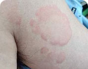 ���ݷ���Ƥ����ҽԺ